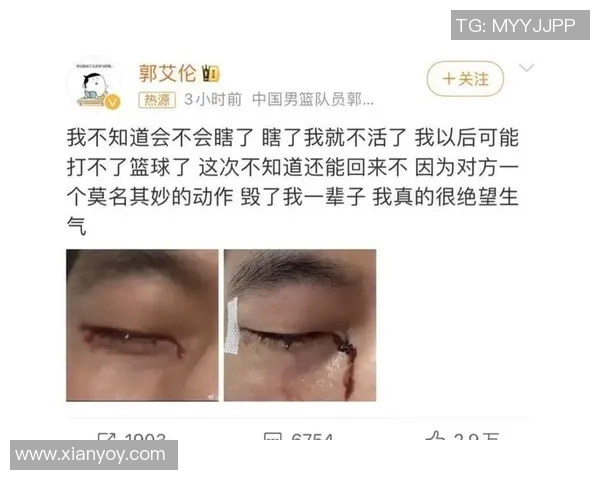 足球巨星赛场受伤痛苦瞬间引发球迷心疼热议